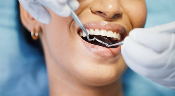 Best Emergency Wisdom Teeth Removal in Englishtown, NJ