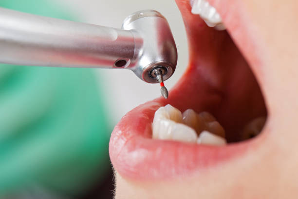 Best Emergency Dental Care for Trauma or Injury in Englishtown, NJ